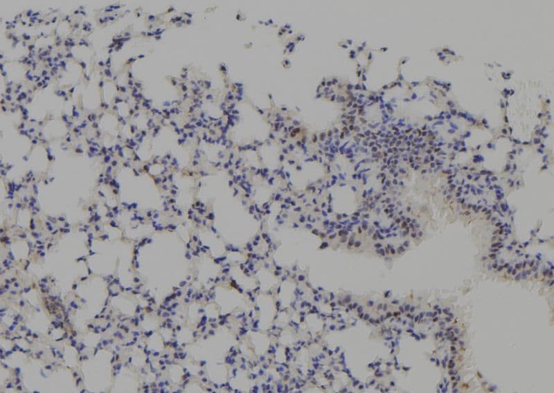CSNK2A1 Antibody