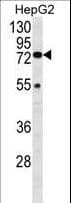 IHC-plus™ HEXA Antibody (aa142-170)