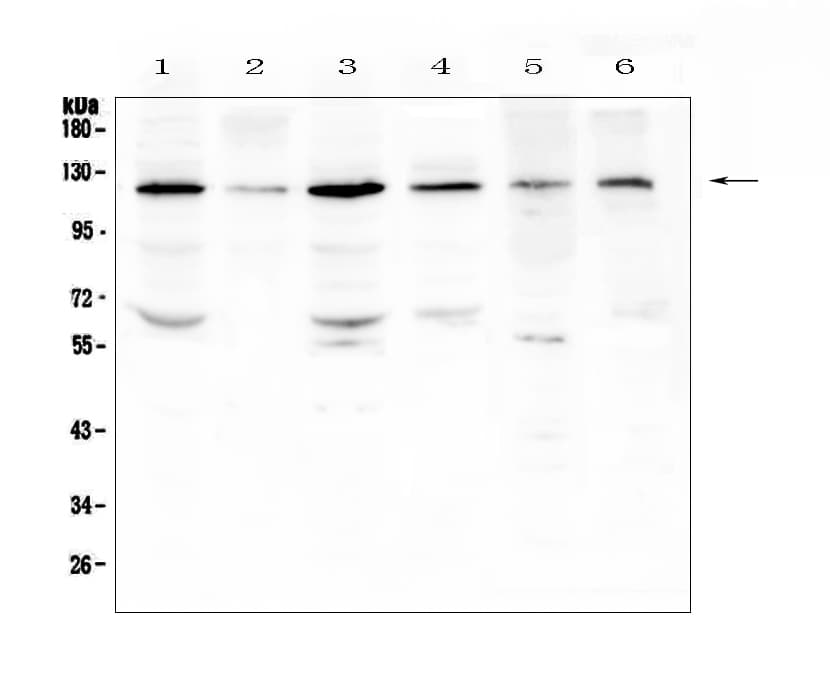 PDGFRB / PDGFR Beta Antibody