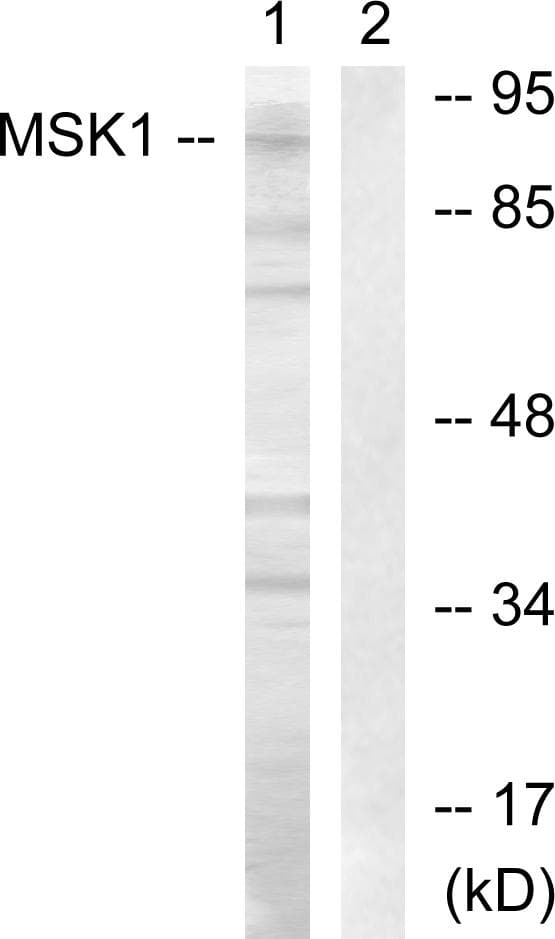 RPS6KA5 / MSK1 Antibody (p360)