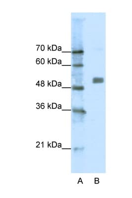 CHRNA9 Antibody (N-Terminus)