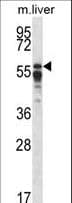 PPP2R5A Antibody (aa418-446)