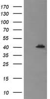 MAPK13 / p38delta Antibody (clone OTI12C3)