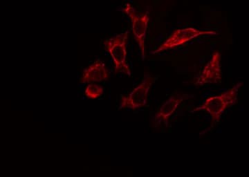 Polyclonal Rabbit anti-Human VAV1 / VAV Antibody (phospho-Tyr174, IHC, IF, WB)
