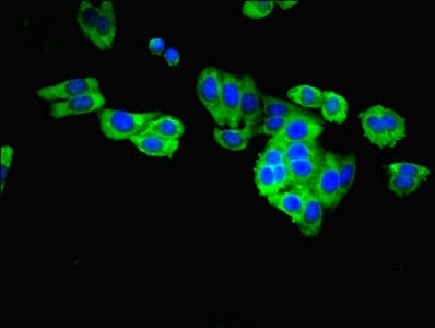 IHC-plus™ Polyclonal Rabbit anti-Human CASP8 / Caspase 8 Antibody (IHC, WB)