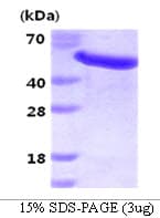 Human GAS7 Protein (Recombinant His)