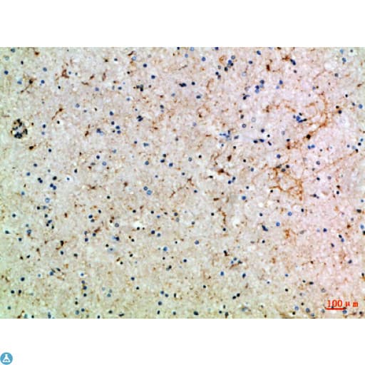 ASIC1 / ACCN2 Antibody