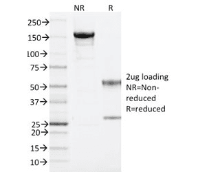 ARF1 Antibody (clone 1A9/5)