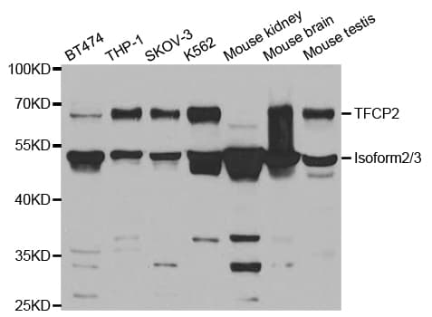 TFCP2 / CP2 Antibody