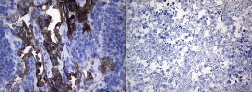 ROS1 / ROS Antibody (aa1882-2125, clone OTI1A1, Carrier-free)