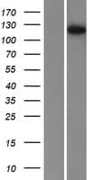 PHKB Protein (Over-Expression Lysate Myc-DDK (Flag))