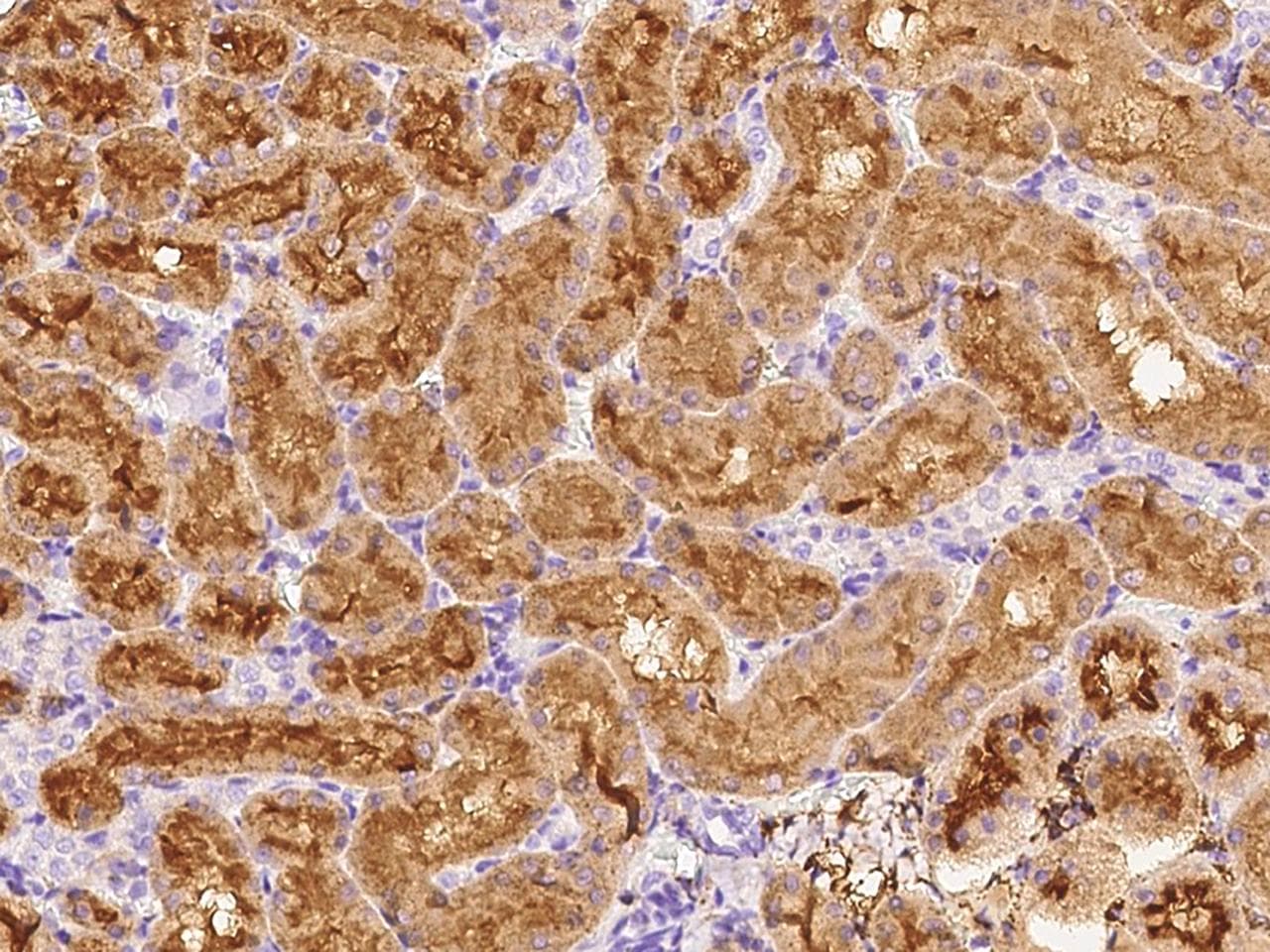 NT5E / eNT / CD73 Antibody (Preservative Free)
