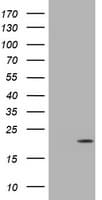 CDKN2C / p18 INK4c Antibody (clone OTI5G1)