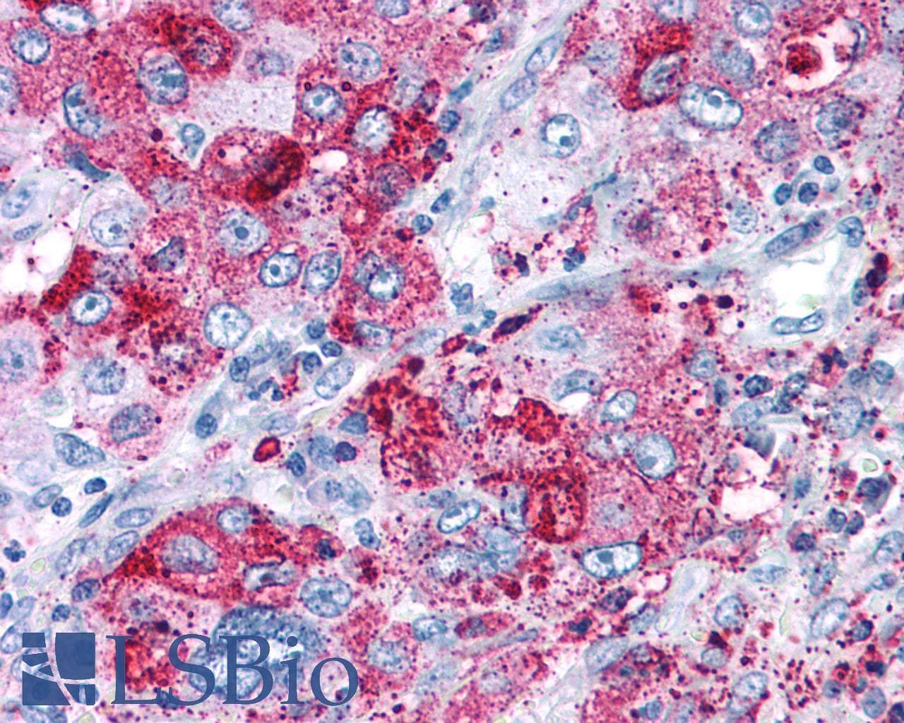 PathPlus™ NPY5R Antibody (Cytoplasmic Domain)