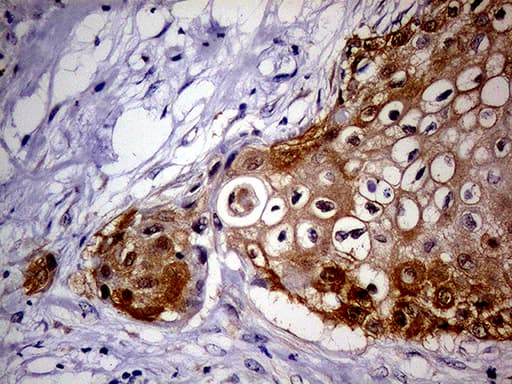 p16INK4a / CDKN2A Antibody (clone OTI11E9, Carrier-free)