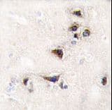 CAMK2A / CaMKII Alpha Antibody (aa446-478)