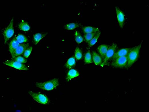 Polyclonal Rabbit anti-Human YIPF3 Antibody (IHC, IF, WB)