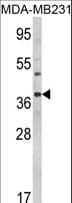 Polyclonal Rabbit anti-Human BAG1 / BAG-1 Antibody (aa258-285, IHC, IF, WB)