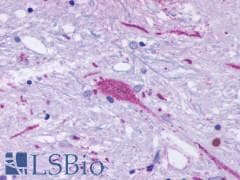 PathPlus™ Polyclonal Rabbit anti-Human GPR137B Antibody (C-Terminus, IHC)