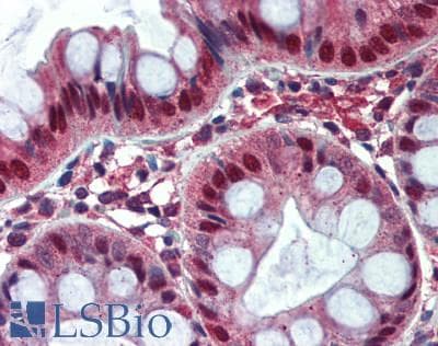 IHC-plus™ SIRT6 / Sirtuin 6 Antibody (aa50-100)