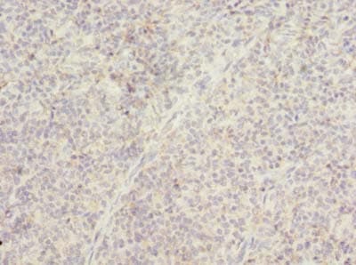 TMTC4 Antibody