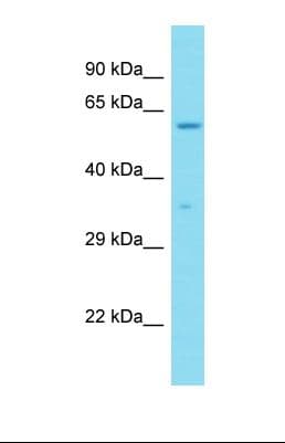 Polyclonal Rabbit anti-Mouse CCDC47 Antibody (aa406-455, WB)