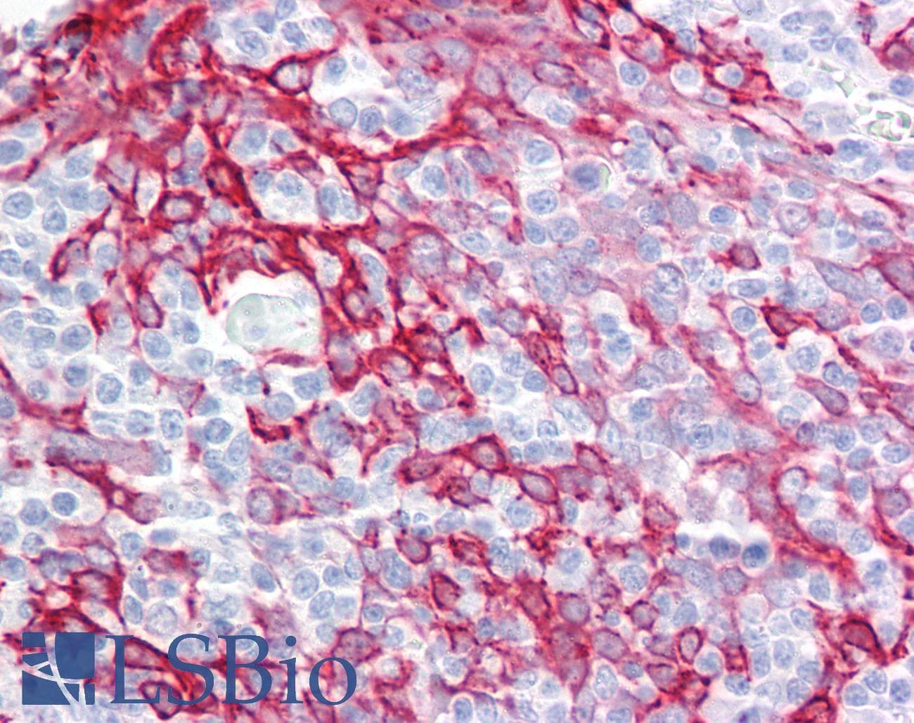IHC-plus™ KRT17 / CK17 / Cytokeratin 17 Antibody (aa381-430)
