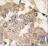 MAPK1 / ERK2 Antibody (aa254-285)