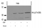 AKT1 Antibody