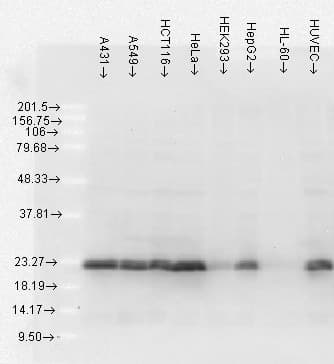IHC-plus™ HSPB1 / HSP27 Antibody (clone 5D12-A12)