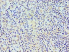 TDP-43 / TARDBP Antibody (aa1-260)
