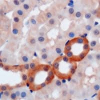 Polyclonal Rabbit anti-Human WIPI2 Antibody (IHC, WB)