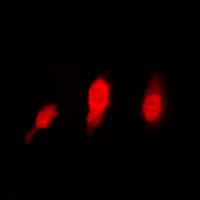 Polyclonal Rabbit anti-Human HDAC6 Antibody (C-Terminus, IHC, IF, WB)