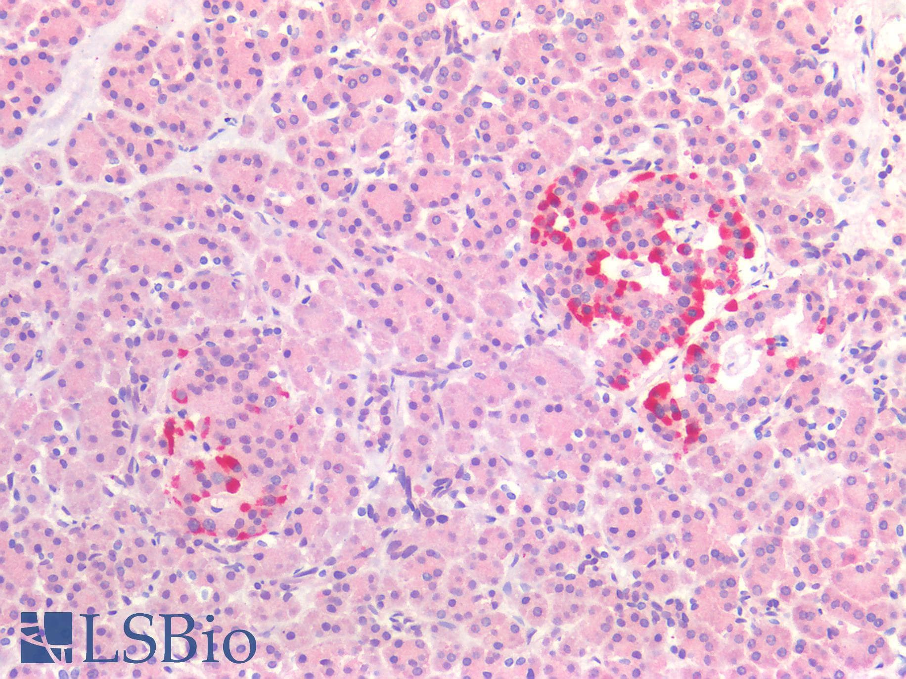 PathPlus™ MAPT / Tau Antibody