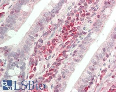 IHC-plus™ Polyclonal Rabbit anti-Human MAPK1 / ERK2 Antibody (aa310-360, IHC, WB)