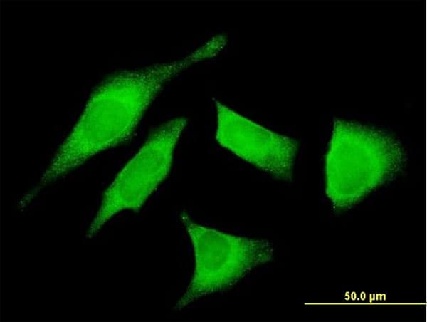 UTRN / Utrophin Antibody (clone 5G6)
