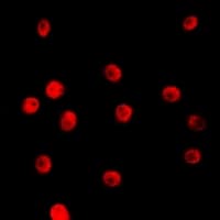 Polyclonal Rabbit anti-Human TCEAL1 Antibody (Internal, IHC, IF, WB)