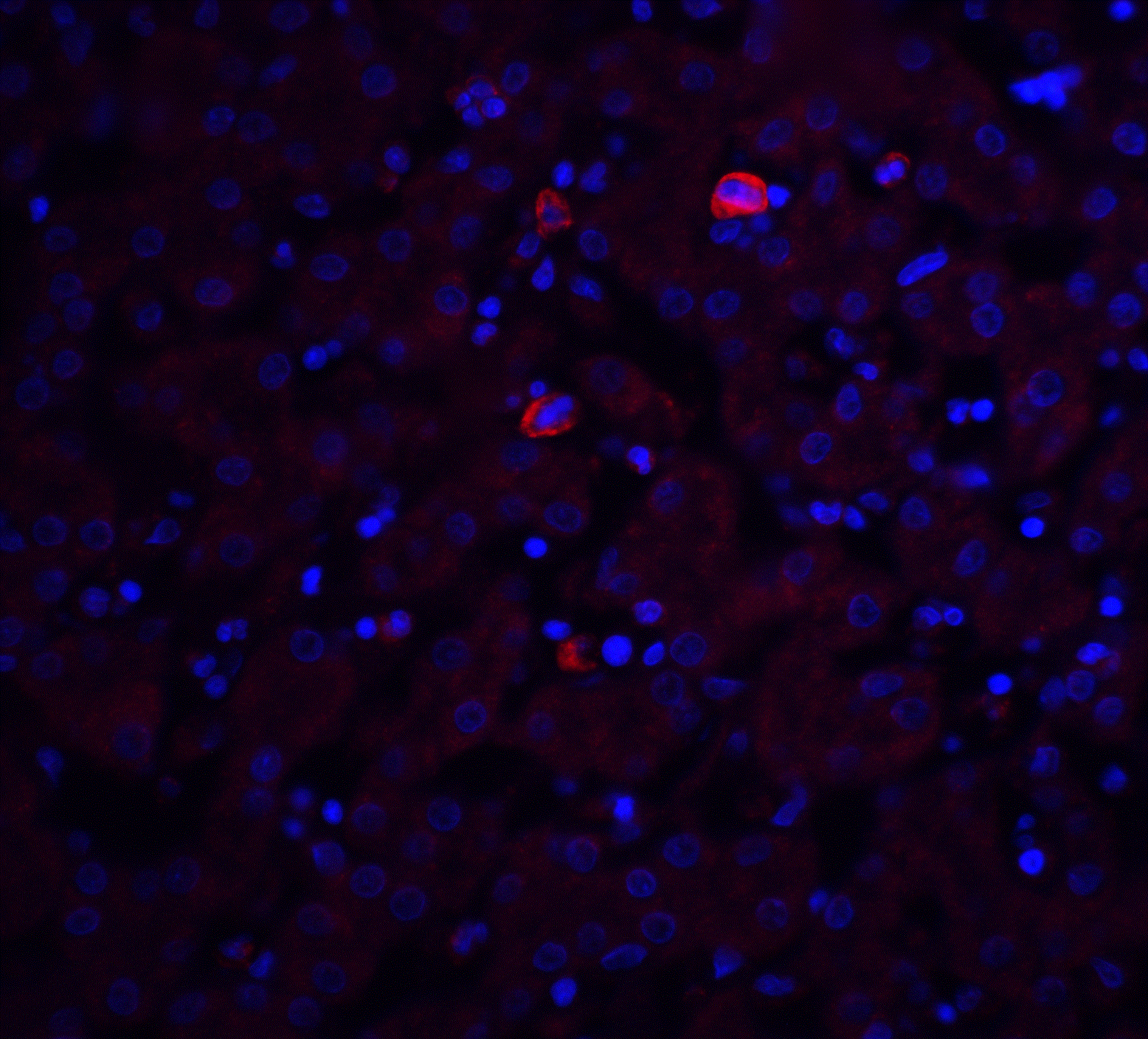 TRO / Trophonin Antibody