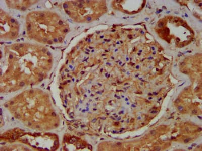 Polyclonal Rabbit anti-Human RAB11FIP5 / RIP11 Antibody (IHC)