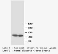 S100B / S100 Beta Antibody (C-Terminus)