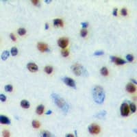 Polyclonal Rabbit anti-Human SNRPA / U1A Antibody (IHC, IF, WB)