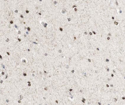 Polyclonal Rabbit anti-Human CREBBP / CREB Binding Protein Antibody (IHC, IF, WB)