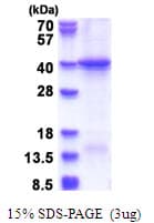 Human CEB1 / HERC5 Protein (Recombinant His)