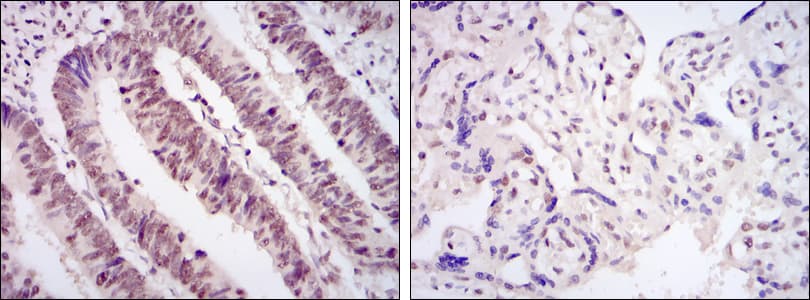 CDK9 Antibody (clone 1B5A7)