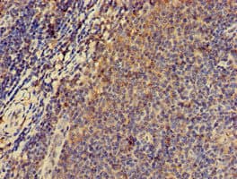 Polyclonal Rabbit anti-Human PRKAR2A Antibody (IHC, IF, WB)