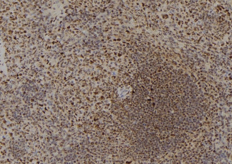 DYRK4 Antibody