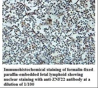 ZNF22 Antibody (aa1-224)