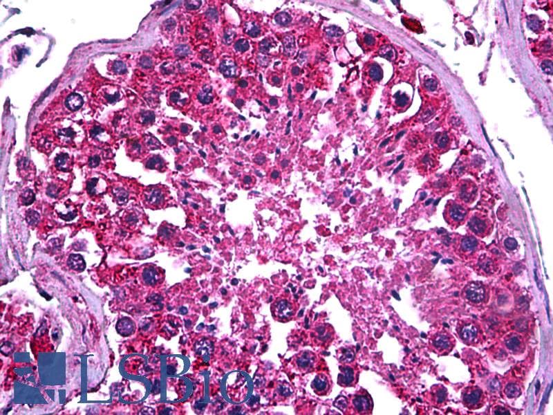 IHC-plus™ Monoclonal Mouse anti-Human PDK2 Antibody (clone 5F8, IHC, WB)