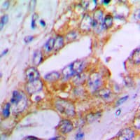 ACAN / Aggrecan Antibody (N-Terminus)