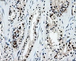 Monoclonal Mouse anti-Human LOX / Lysyl Oxidase Antibody (clone OTI6B11, IHC, IF, WB)